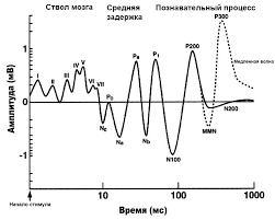 Вызванные потенциалы мозга (ВП)