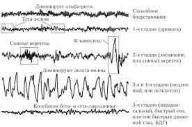 Стадии сна - ФИЗИОЛОГИЯ ВЫСШЕЙ НЕРВНОЙ ДЕЯТЕЛЬНОСТИ И СЕНСОРНЫХ СИСТЕМ