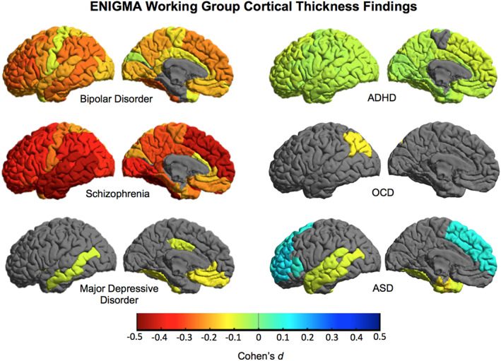 https://cdn.ncbi.nlm.nih.gov/pmc/blobs/1c1d/8675426/9d3c70de3df1/HBM-43-56-g008.jpg