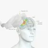 Транскраниальная магнитная стимуляция
